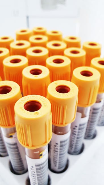 The image displays a close-up of multiple blood sample tubes with bright yellow caps, arranged in a neat cluster. The tubes are made of transparent glass or plastic, showing the dark red blood samples